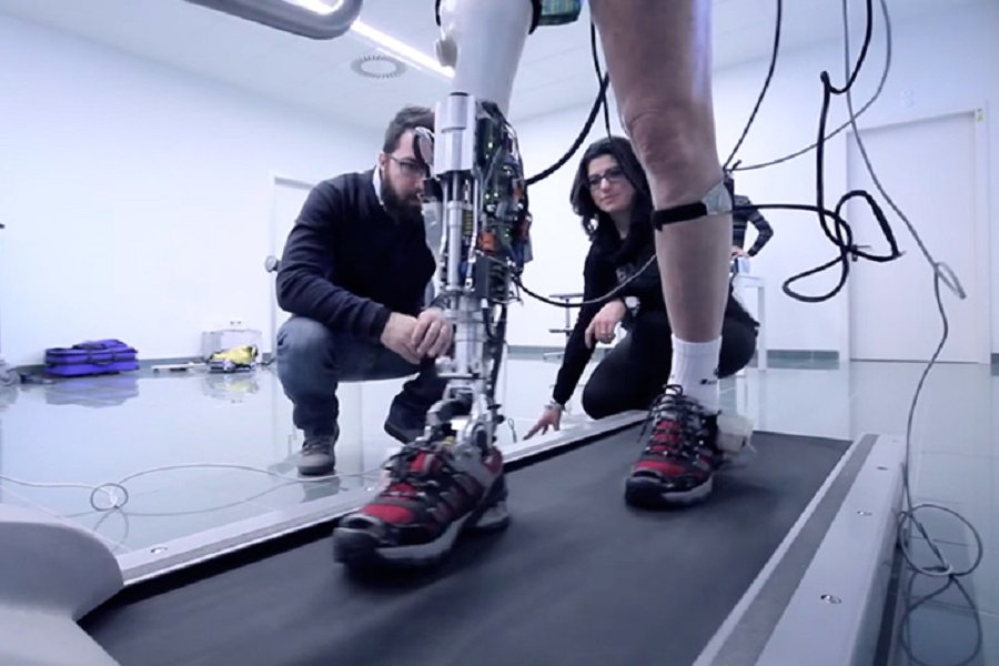 Expanded prosthetics and organ engineering. Bebionic протезы. Костомаров бионические протезы. Василий бионические протезы. Джесси Салливан бионические протезы.